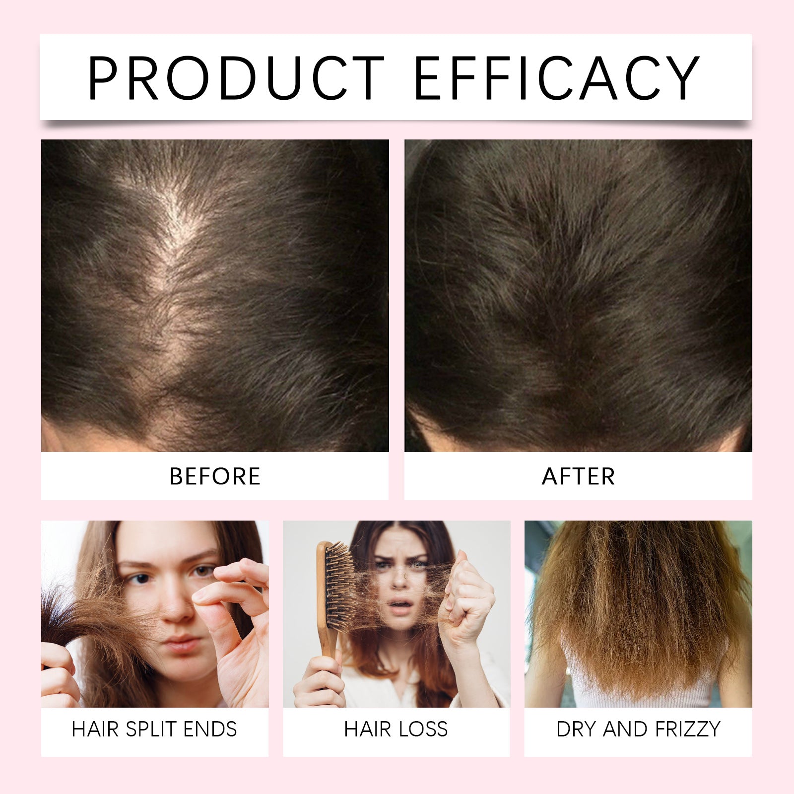 HOEGOA Hair Spray: Gently moisturizes hair, nourishes the scalp, strengthens and brightens hair – a new hair care experience.